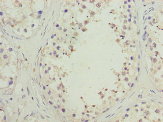 Immunohistochemistry of paraffin-embedded human testis tissue using CSB-PA864023LA01HU at dilution of 1:100