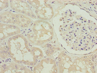 Immunohistochemistry of paraffin-embedded human kidney tissue using CSB-PA864023LA01HU at dilution of 1:100