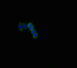 CSB-PA867155LA01HU