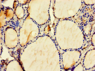 Immunohistochemistry of paraffin-embedded human thyroid tissue using CSB-PA867172LA01HU at dilution of 1:100
