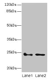 CSB-PA867192LA01HU WB