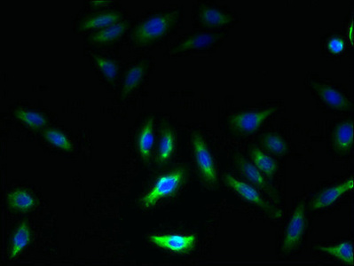 Immunofluorescence staining of HepG2 cells with CSB-PA872487LA01HU at 1:133, counter-stained with DAPI. The cells were fixed in 4% formaldehyde, permeabilized using 0.2% Triton X-100 and blocked in 10% normal Goat Serum. The cells were then incubated with the antibody overnight at 4°C. The secondary antibody was Alexa Fluor 488-congugated AffiniPure Goat Anti-Rabbit IgG(H+L).