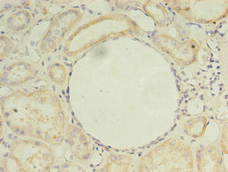 Immunohistochemistry of paraffin-embedded human kidney tissue using CSB-PA873612LA01HU at dilution of 1:100 Immunohistochemistry of paraffin-embedded human kidney tissue using CSB-PA873612LA01HU at dilution of 1:100