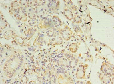 Immunohistochemistry of paraffin-embedded human pancreatic tissue using CSB-PA873671LA01HU at dilution of 1:100