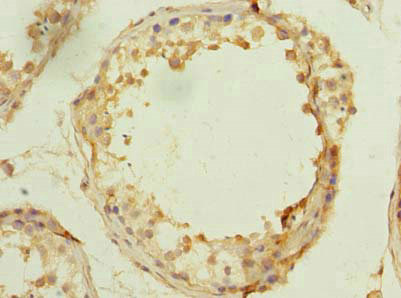 Immunohistochemistry of paraffin-embedded human testis tissue using CSB-PA880106LA01HU at dilution of 1:100