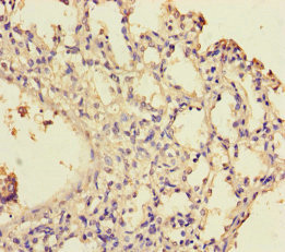 Immunohistochemistry of paraffin-embedded human lung tissue using CSB-PA881001LA01HU at dilution of 1:100