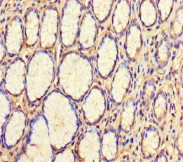 Immunohistochemistry of paraffin-embedded human stomach tissue using CSB-PA881001LA01HU at dilution of 1:100