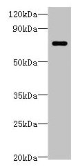 Western blot All lanes: LRRC40 antibody at 2ug/ml + 293T whole cell lysate Secondary Goat polyclonal to rabbit IgG at 1/10000 dilution Predicted band size: 69 kDa Observed band size: 69 kDa Western blot All lanes: LRRC40 antibody at 2ug/ml + 293T whole cell lysate Secondary Goat polyclonal to rabbit IgG at 1/10000 dilution Predicted band size: 69 kDa Observed band size: 69 kDa