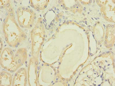 Immunohistochemistry of paraffin-embedded human kidney tissue using CSB-PA882135LA01HU at dilution of 1:100