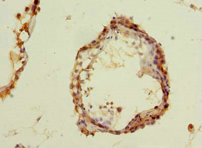 Immunohistochemistry of paraffin-embedded human testis tissue using CSB-PA882135LA01HU at dilution of 1:100