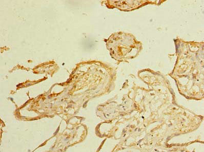 Immunohistochemistry of paraffin-embedded human placenta tissue using CSB-PA882141LA01HU at dilution of 1:100 Immunohistochemistry of paraffin-embedded human placenta tissue using CSB-PA882141LA01HU at dilution of 1:100