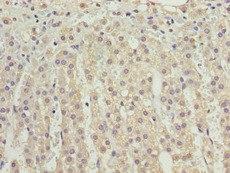 CSB-PA884484LA01HU IHC