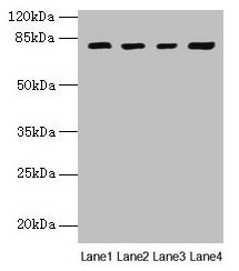 Western Blotting(WB) - DHX35 Antibody