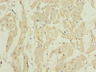 Immunohistochemistry of paraffin-embedded human heart tissue using CSB-PA888023LA01HU at dilution of 1:100