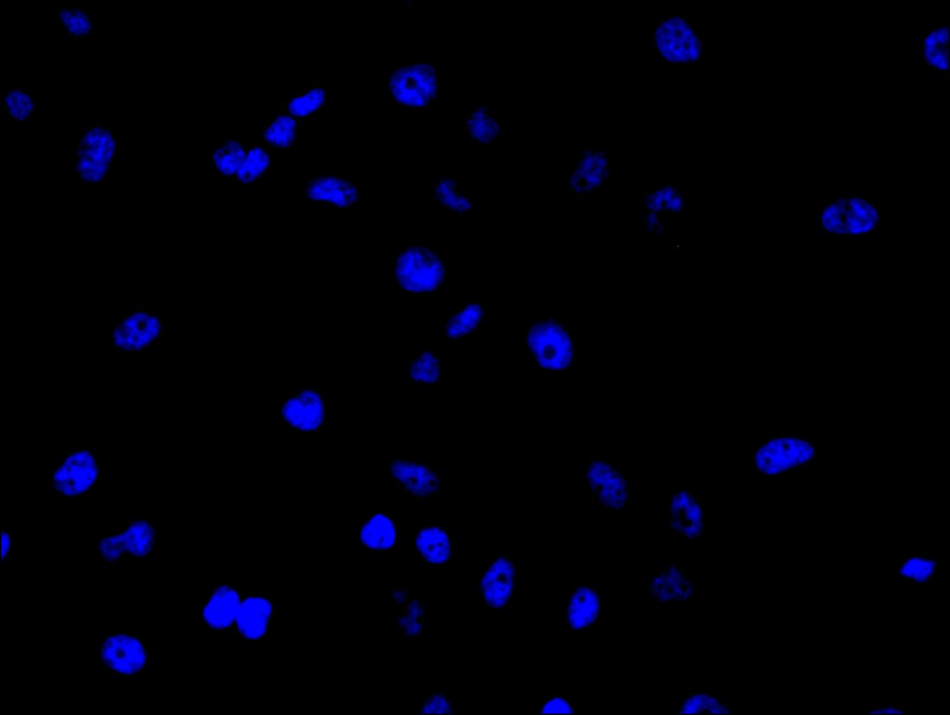 CSB-PA891571LA01HU