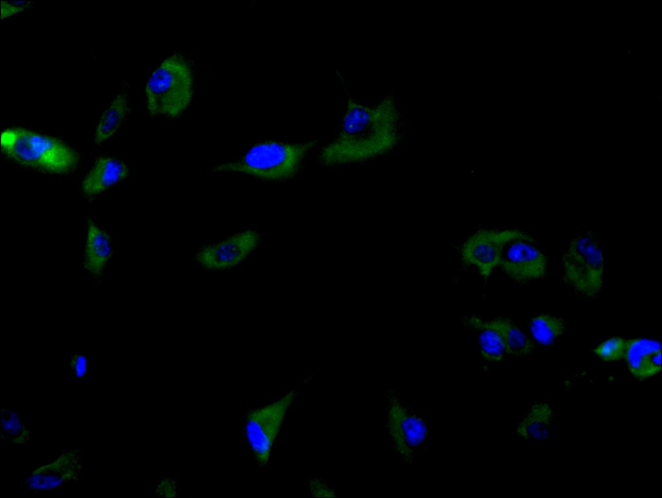 CSB-PA891571LA01HU