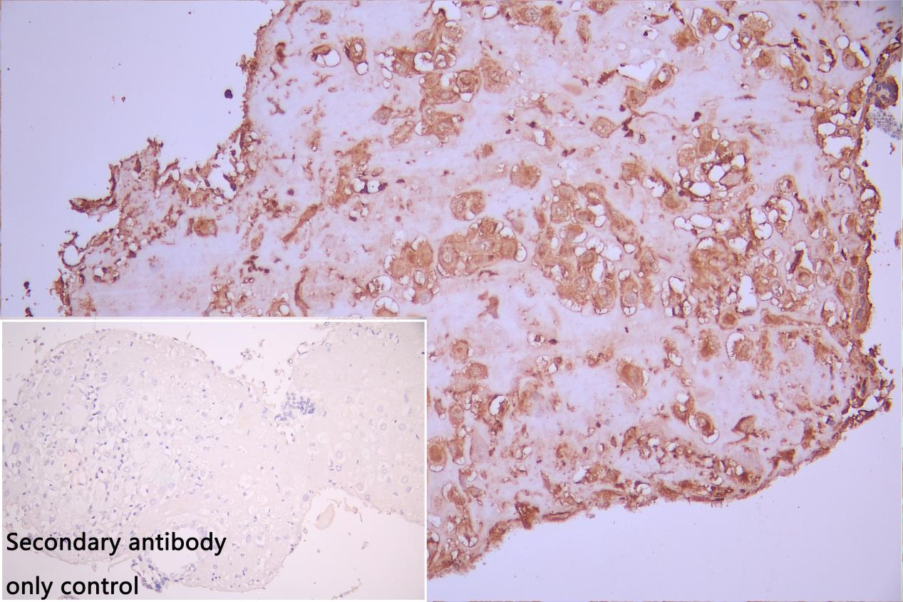 CSB-PA891571LA01HU