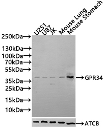 CSB-PA891571LA01HU