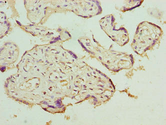 Immunohistochemistry of paraffin-embedded human placenta tissue using CSB-PA896899LA01HU at dilution of 1:100