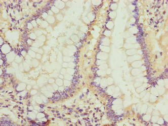 Immunohistochemistry of paraffin-embedded human small intestine tissue using CSB-PA896899LA01HU at dilution of 1:100