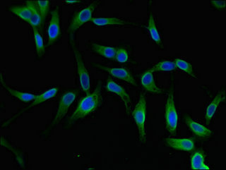 Immunofluorescent analysis of Hela cells using CSB-PA896902LA01HU at dilution of 1:100 and Alexa Fluor 488-congugated AffiniPure Goat Anti-Rabbit IgG(H+L)