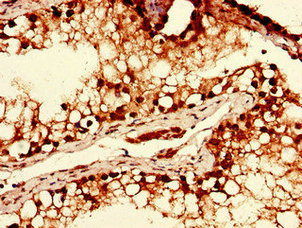 Immunohistochemistry of paraffin-embedded human testis tissue using CSB-PA896902LA01HU at dilution of 1:100