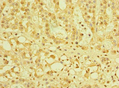 Immunohistochemistry of paraffin-embedded human adrenal gland tissue using CSB-PA897538LA01HU at dilution of 1:100