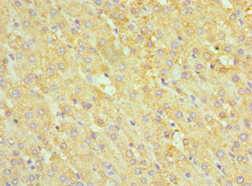 Immunohistochemistry of paraffin-embedded human liver tissue using CSB-PA001032ESR1HU at dilution of 1:100