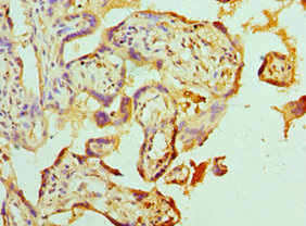 Immunohistochemistry of paraffin-embedded human placenta tissue using CSB-PA001032ESR1HU at dilution of 1:100