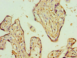 Immunohistochemistry of paraffin-embedded human placenta tissue using CSB-PA001398ESR1HU at dilution of 1:100