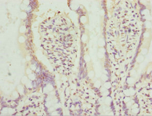CSB-PA001450ESR2HU
