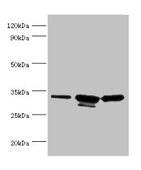 Western blot All lanes: CAPZB antibody at 6microg/ml Lane 1: 293T whole cell lysate Lane 2: A431 whole cell lysate Lane 3: Jurkat whole cell lysate Secondary Goat polyclonal to rabbit IgG at 1/10000 dilution Predicted band size: 32, 31 kDa Observed band size: 32, 31 kDa