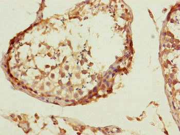 Immunohistochemistry of paraffin-embedded human testis tissue using CSB-PA004769ESR2HU at dilution of 1:100 Immunohistochemistry of paraffin-embedded human testis tissue using CSB-PA004769ESR2HU at dilution of 1:100