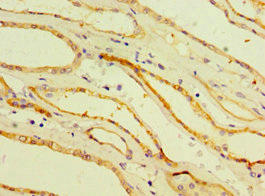 Immunohistochemistry of paraffin-embedded human kidney tissue using CSB-PA005041ESR1HU at dilution of 1:100 Immunohistochemistry of paraffin-embedded human kidney tissue using CSB-PA005041ESR1HU at dilution of 1:100