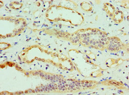 Immunohistochemistry of paraffin-embedded human kidney tissue using CSB-PA005494ESR1HU at dilution of 1:100