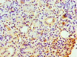 Immunohistochemistry of paraffin-embedded human pancreatic tissue using CSB-PA005494ESR1HU at dilution of 1:100