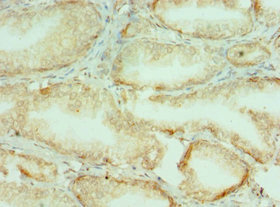 Immunohistochemistry of paraffin-embedded human prostate tissue using CSB-PA005715ESR1HU at dilution of 1:100