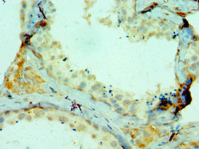 Immunohistochemistry of paraffin-embedded human testis tissue using CSB-PA005715ESR1HU at dilution of 1:100
