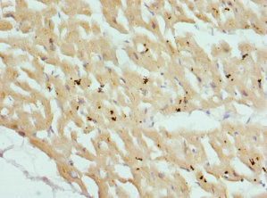 Immunohistochemistry of paraffin-embedded human heart tissue using CSB-PA006087ESR1HU at dilution of 1:100