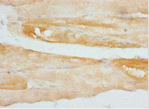 Immunohistochemistry of paraffin-embedded human skeletal muscle tissue using CSB-PA006087ESR1HU at dilution of 1:100