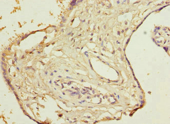 Immunohistochemistry of paraffin-embedded human placenta tissue using CSB-PA006563ESR1HU at dilution of 1:100