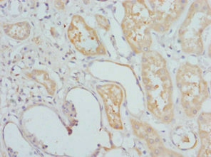 Immunohistochemistry of paraffin-embedded human kidney tissue using CSB-PA006953DSR2HU at dilution of 1:100