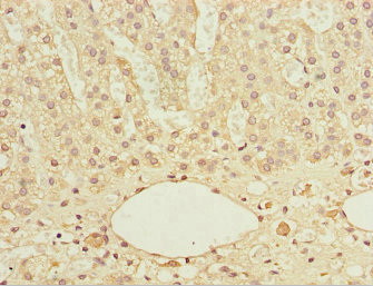 Immunohistochemistry of paraffin-embedded human adrenal gland tissue using CSB-PA007226DSR2HU at dilution of 1:100