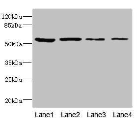 CSB-PA007399ESR1HU