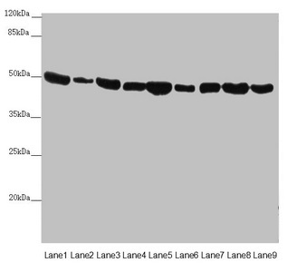 Western blot All lanes: EEF1G antibody at 0.73microg/ml Lane 1: Mouse gonadal tissue Lane 2: Mouse brain tissue Lane 3: HL60 whole cell lysate Lane 4: NIH/3T3 whole cell lysate Lane 5: PC-3 whole cell lysate Lane 6: HepG2 whole cell lysate Lane 7: Hela whole cell lysate Lane 8: 293T whole cell lysate Lane 9: RAW264.7 whole cell lysate Secondary Goat polyclonal to rabbit IgG at 1/10000 dilution Predicted band size: 51, 57 kDa Observed band size: 51 kDa