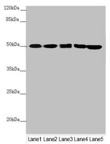 Western blot All lanes: EEF1G antibody at 0.78microg/ml Lane 1: Mouse gonadal tissue Lane 2: PC-3 whole cell lysate Lane 3: HepG2 whole cell lysate Lane 4: Hela whole cell lysate Lane 5: 293T whole cell lysate Secondary Goat polyclonal to rabbit IgG at 1/10000 dilution Predicted band size: 51, 57 kDa Observed band size: 51 kDa