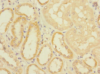Immunohistochemistry of paraffin-embedded human kidney tissue using CSB-PA007558ESR1HU at dilution of 1:100