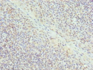 Immunohistochemistry of paraffin-embedded human tonsil tissue using CSB-PA007596DSR2HU at dilution of 1:100
