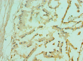 Immunohistochemistry of paraffin-embedded human prostate tissue using CSB-PA008842DSR1HU at dilution of 1:100