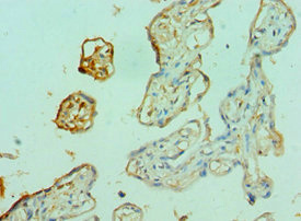 Immunohistochemistry of paraffin-embedded human placenta tissue using CSB-PA008842DSR1HU at dilution of 1:100